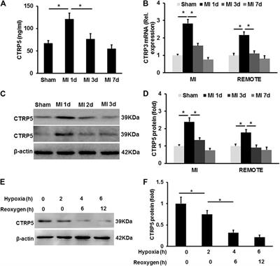 CTRP5-Overexpression Attenuated Ischemia-Reperfusion Associated Heart Injuries and Improved Infarction Induced Heart Failure